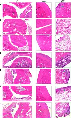 Multi-omics analysis to reveal the synergistic mechanism underlying the multiple ingredients of Stephania tetrandra extract on rheumatoid arthritis through the PI3K/Akt signaling pathway